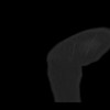 SPORK, NICO - 22.03.1976 - 02.08.2022 - CT obere Extremität - 17:59:07